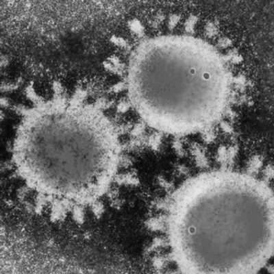Foto real del coronavirus de la Covid19